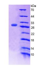 Recombinant Mediator Complex Subunit 1 (MED1)