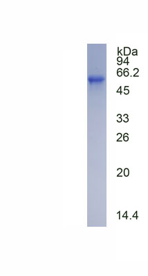 Recombinant Thyroid Hormone Receptor Alpha (THRa)