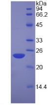 Recombinant Nucleolin (NCL)