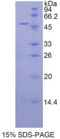 Recombinant Nucleolin (NCL)