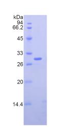 Recombinant Nucleolin (NCL)