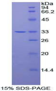 Recombinant Phosphoinositide Dependent Protein Kinase 1 (PDPK1)