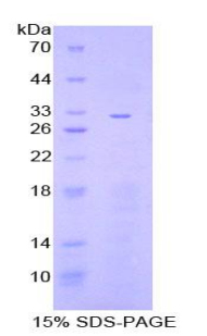 Recombinant Inhibitory Subunit Of NF Kappa B Zeta (IkBz)