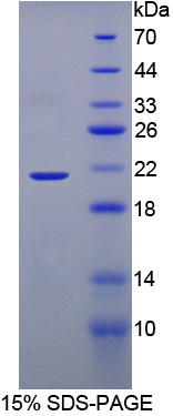 Recombinant Bromodomain Containing Protein 8 (BRD8)