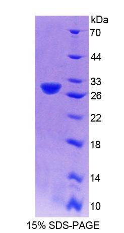 Recombinant Centromere Protein J (CENPJ)