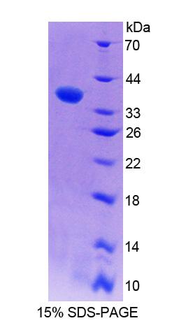 Recombinant Erythrocyte Membrane Protein Band 4.1 (EPB41)
