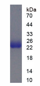 Recombinant Disrupted In Schizophrenia 1 (DISC1)