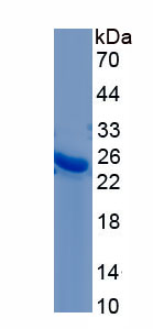 Recombinant Disrupted In Schizophrenia 1 (DISC1)