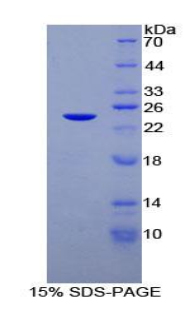 Recombinant Disrupted In Schizophrenia 1 (DISC1)