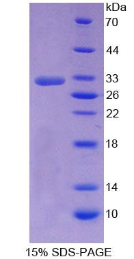 Recombinant Nuclear Receptor Subfamily 0,Group B,Member 2 (NR0B2)