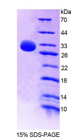 Recombinant Nuclear Receptor Subfamily 0,Group B,Member 2 (NR0B2)