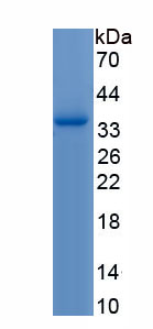 Recombinant 11-Beta-Hydroxysteroid Dehydrogenase Type 1 (HSD11b1)