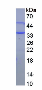 Recombinant 11-Beta-Hydroxysteroid Dehydrogenase Type 1 (HSD11b1)