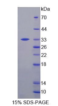 Recombinant 2',3'-Cyclic Nucleotide 3'-Phosphodiesterase (CNP)