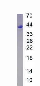 Recombinant 7-Dehydrocholesterol Reductase (DHCR7)