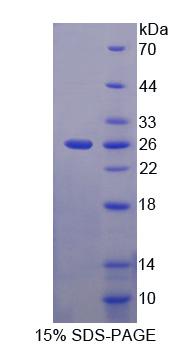 Recombinant Adrenocortical Dysplasia Homolog (ACD)