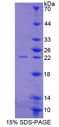 Recombinant Adrenocortical Dysplasia Homolog (ACD)