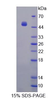 Recombinant Aminoacylase 1 (ACY1)