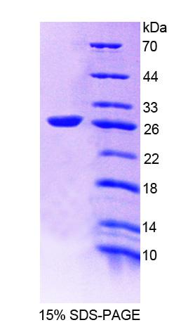 Recombinant Alpha Adducin (ADD1)