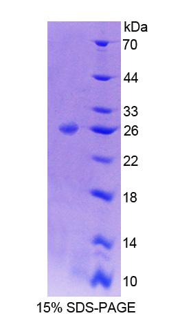 Recombinant Alpha Adducin (ADD1)