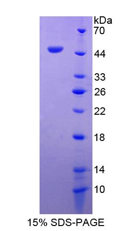 Recombinant Adhesion Regulating Molecule 1 (ADRM1)