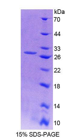 Recombinant Actin Filament Associated Protein 1 (AFAP1)
