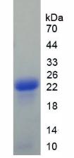 Recombinant Afamin (AFM)