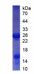 Recombinant Afamin (AFM)