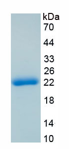 Recombinant Anterior Gradient 2 (AGR2)