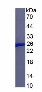 Recombinant Anterior Gradient 2 (AGR2)