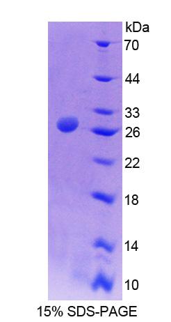 Recombinant Alanine Glyoxylate Aminotransferase (AGXT)