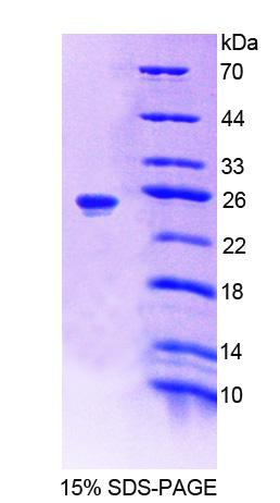 Recombinant Alanine Glyoxylate Aminotransferase (AGXT)