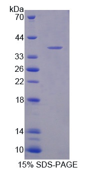 Recombinant Allograft inflammatory factor 1 (AIF1)