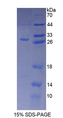 Recombinant Aryl Hydrocarbon Receptor Interacting Protein (AIP)