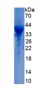 Recombinant Anthrax Toxin Receptor 1 (ANTXR1)