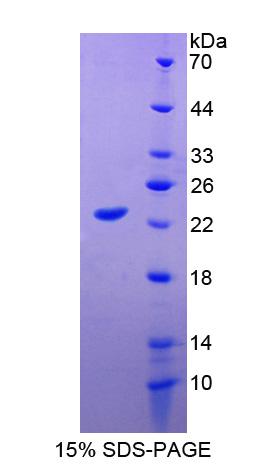 Recombinant Apolipoprotein M (APOM)