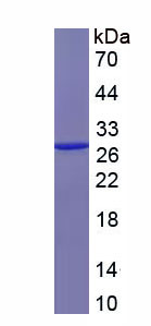 Recombinant Apolipoprotein M (APOM)