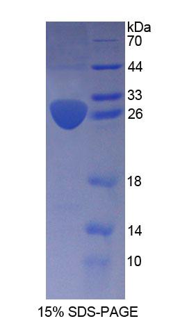 Recombinant Aryl Hydrocarbon Receptor Nuclear Translocator 2 (ARNT2)