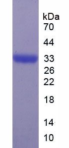 Recombinant N-Acylsphingosine Amidohydrolase 1 (ASAH1)