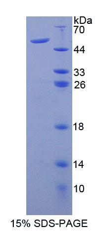 Recombinant Ancient Ubiquitous Protein 1 (AUP1)