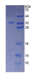 Recombinant Aurora Kinase C (AURKC)