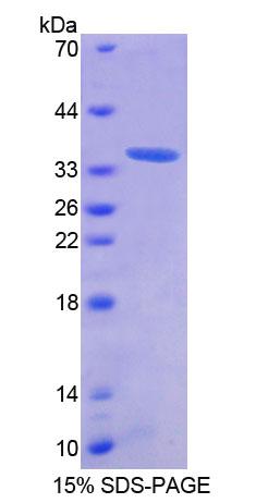 Recombinant Antizyme Inhibitor 1 (AZIN1)