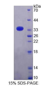 Recombinant Antizyme Inhibitor 1 (AZIN1)