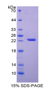 Recombinant Adenine Phosphoribosyltransferase (APRT)