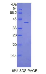 Recombinant Angiotensin III (AngIII)