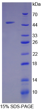 Recombinant Antithrombin (AT)