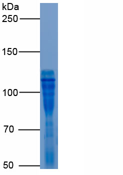 Recombinant Ectonucleotide Pyrophosphatase/Phosphodiesterase 2 (ENPP2)