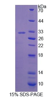 Recombinant Bcl6 Corepressor (BCOR)