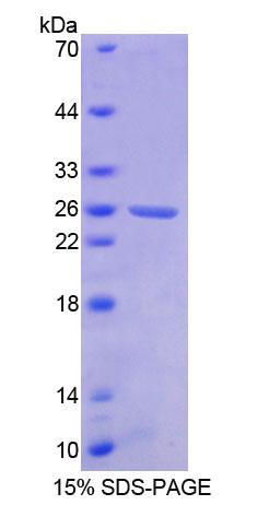 Recombinant Breakpoint Cluster Region (BCR)