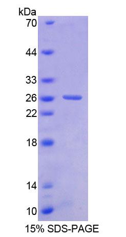 Recombinant Basonuclin 1 (BNC1)